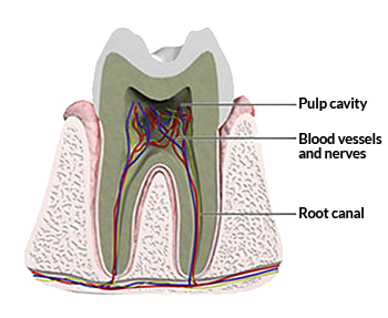One-Visit Root Canals